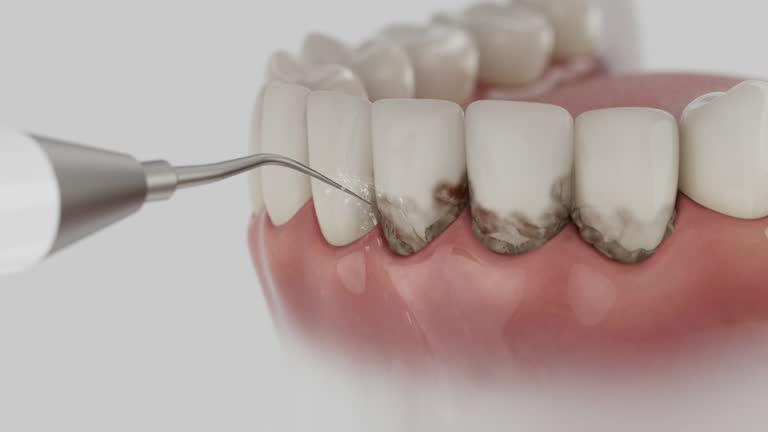 Reliable Dental contractor in Sandy Hook, CT by Smile Center Dentistry